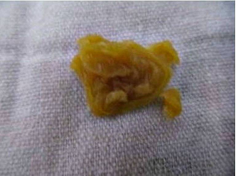 отливать воском значение фигур. колокольчик на воске. отливание воском испуг. фигуры на отливках восковых. на воске вылилась пещера.