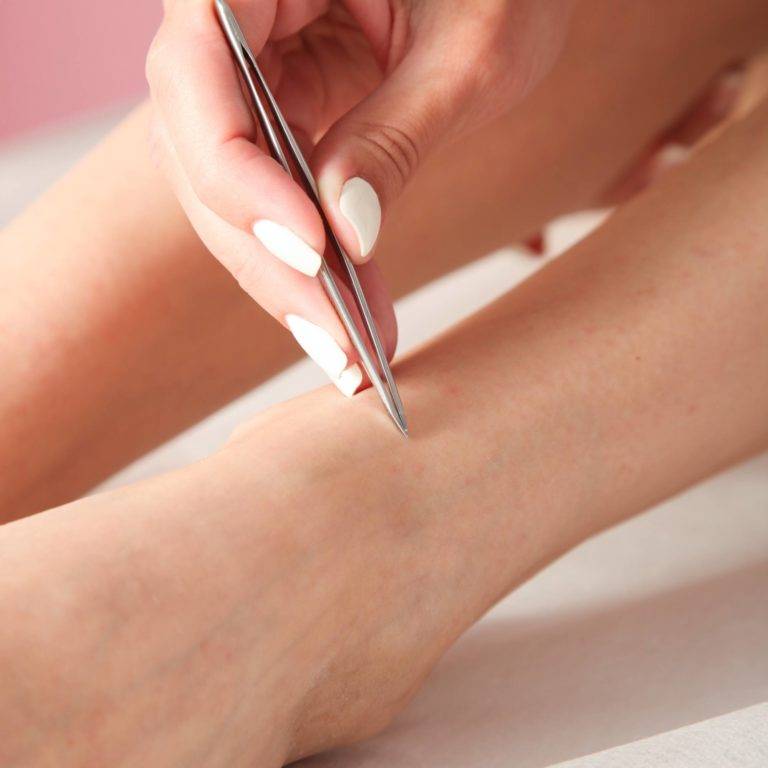 Удалить волосы на теле в домашних условиях