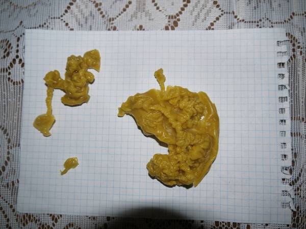 Рисунок при отливке воском